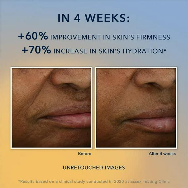 RoC Skincare - Multi Correxion®️ - Revive + Glow Gel Cream with Vitamin C (50ml), RoC Skincare