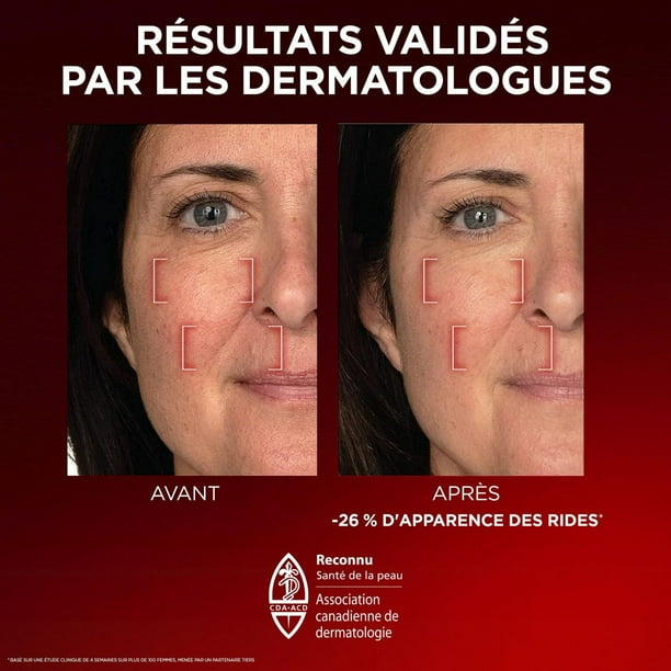 L'Oréal Paris Triple Power LZR Fragrance Free Day Cream, Pro Retinol, Anti-Aging Cream, 50 mL