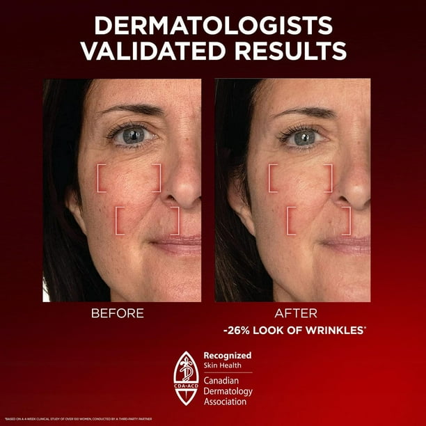 L'Oréal Paris Triple Power LZR Fragrance Free Day Cream, Pro Retinol, Anti-Aging Cream, 50 mL