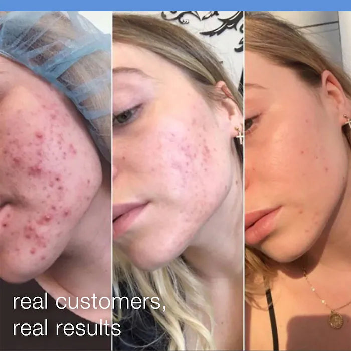 Dermalogica  Daily Microfoliant Refillable Exfoliator