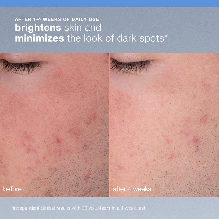 Dermalogica  Daily Microfoliant Refillable Exfoliator