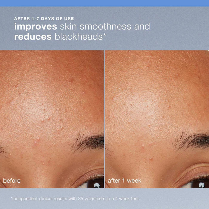 Dermalogica  Daily Microfoliant Refillable Exfoliator