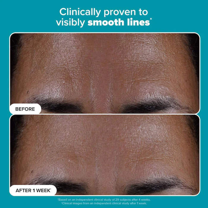 Paula's Choice  Skin Perfecting 2% BHA Exfoliating Toner for Clear Skin