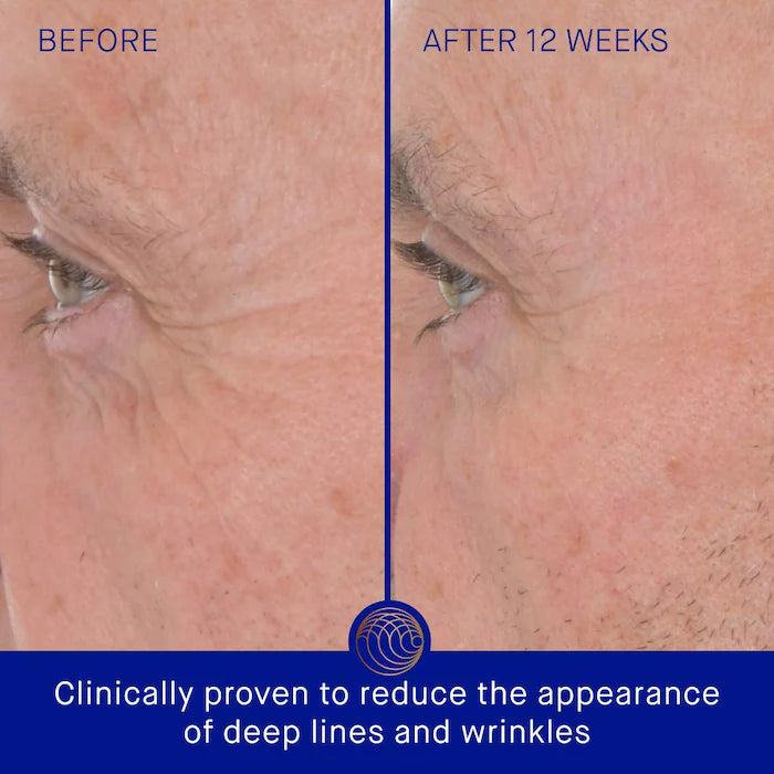 Augustinus Bader The Retinol Serum