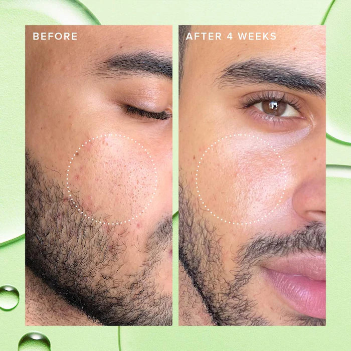 Farmacy  Deep Sweep 2% BHA Pore Cleaning Toner with Moringa + Papaya