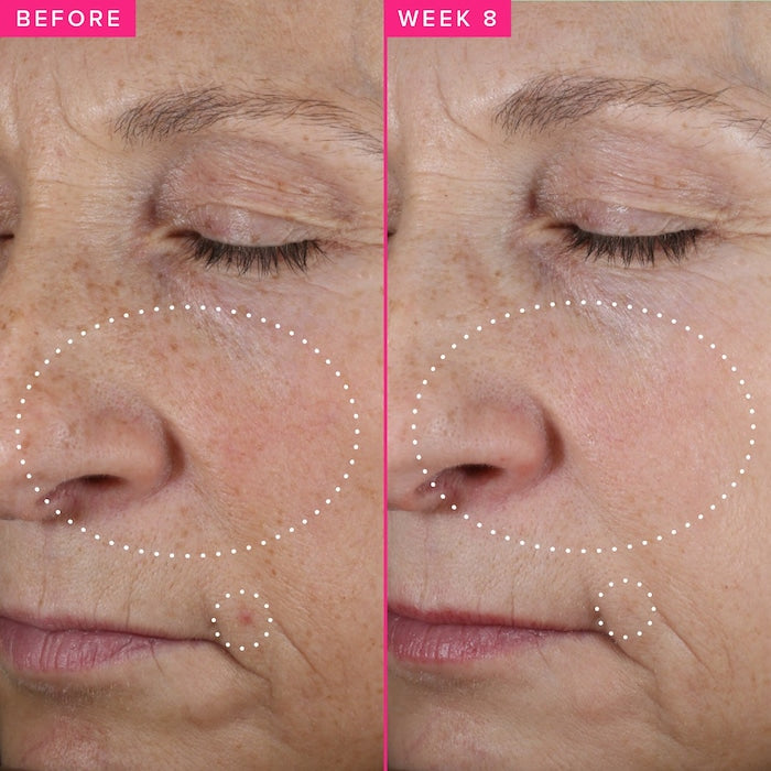 Farmacy  Brighten Up 3% TXA Dark Spot Toner with Azelaic Acid