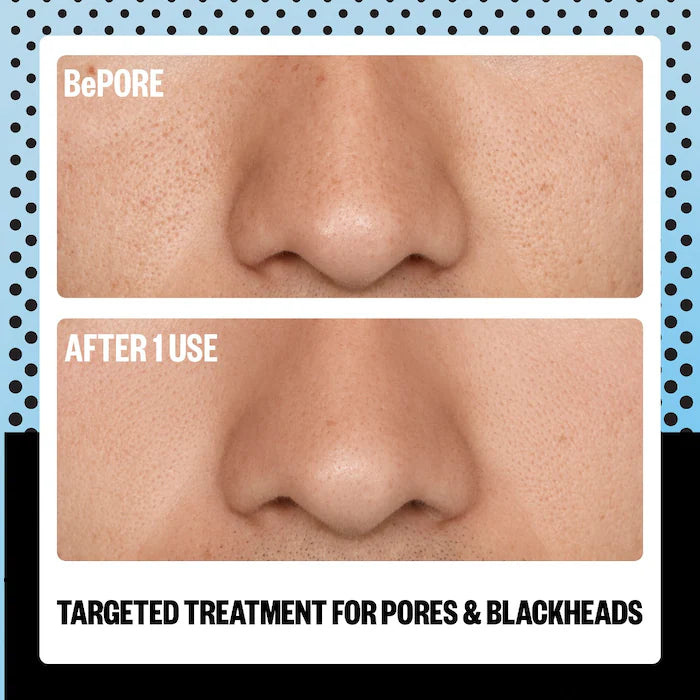 Peace Out  AHA Pore & Blackhead Exfoliator Multitasking Treatment Stick