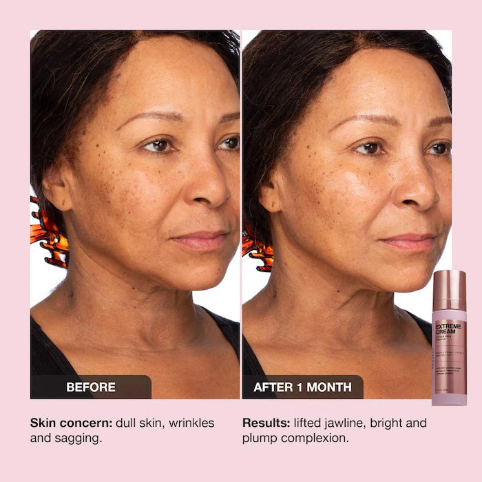 iNNBEAUTY PROJECT  Extreme Cream Anti-Aging, Firming, & Lifting Refillable Moisturizer