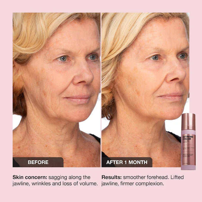 iNNBEAUTY PROJECT  Extreme Cream Anti-Aging, Firming, & Lifting Refillable Moisturizer