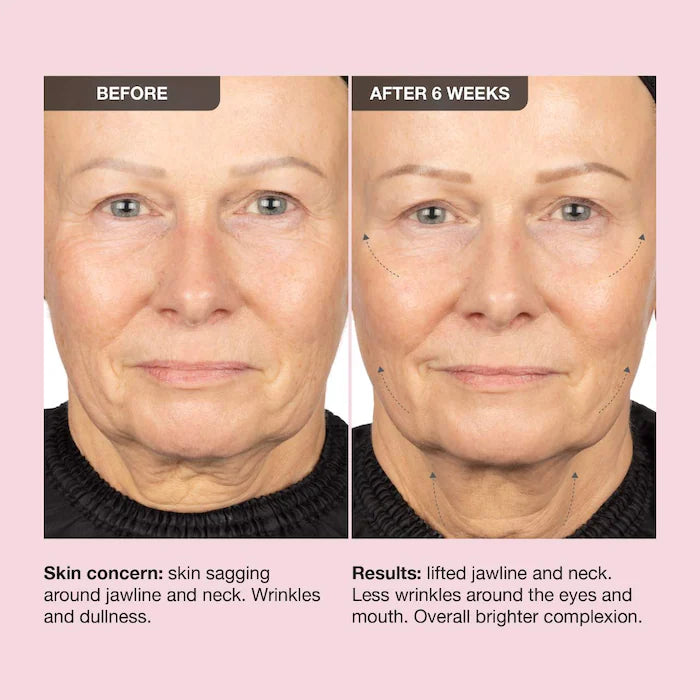 iNNBEAUTY PROJECT  Extreme Cream Anti-Aging, Firming, & Lifting Refillable Moisturizer