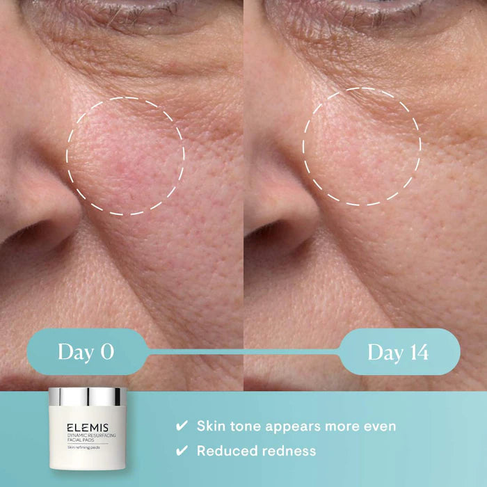 Elemis  Dynamic Gentle Resurfacing Pads with Lactic Acid