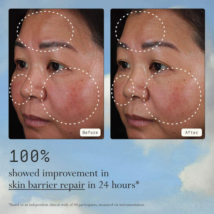 Dieux  Instant Angel Lipid & Peptide-Rich Moisturizer + Barrier Repair