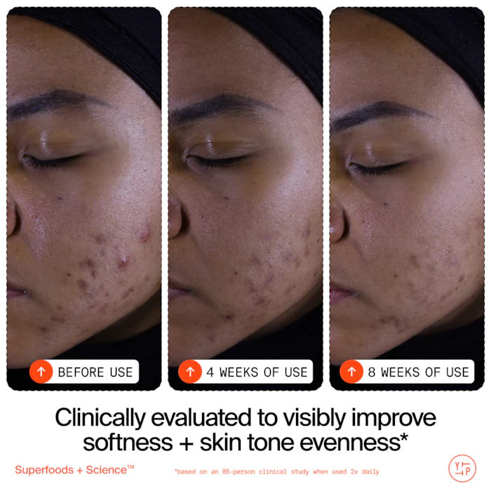Youth To The People  Superfruit Gentle Exfoliating Cleanser with Vitamin C + Papaya 504 | Ask a question | 53.2K