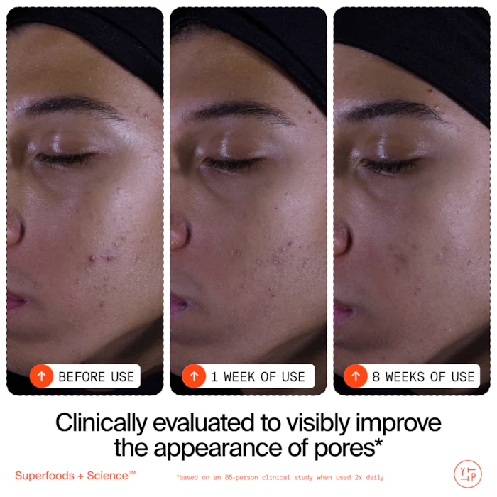 Youth To The People  Superfruit Gentle Exfoliating Cleanser with Vitamin C + Papaya 504 | Ask a question | 53.2K