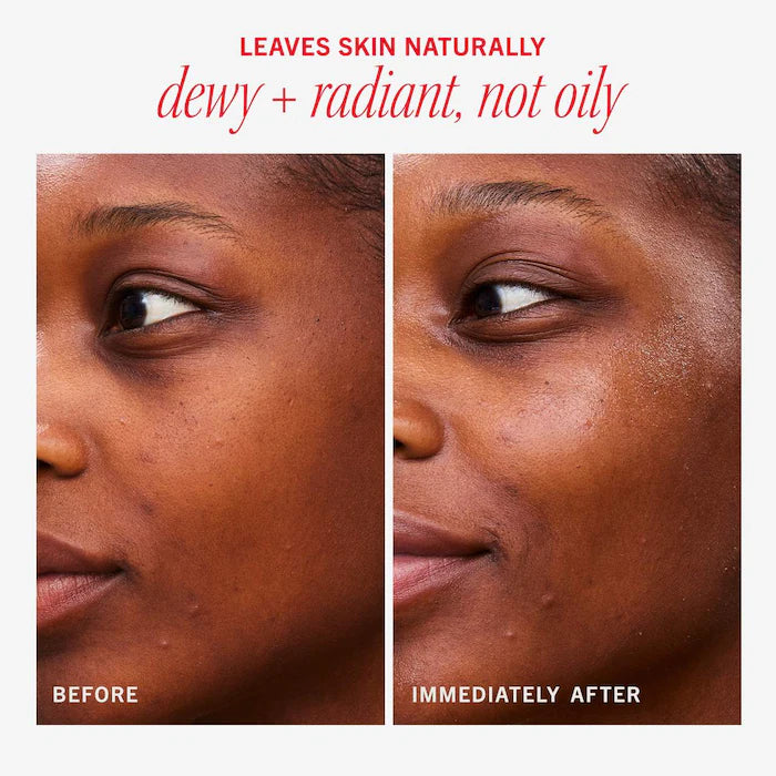 First Aid Beauty  Hydrating Dewy Gel Cream Moisturizer with Hyaluronic Acid + Ceramides