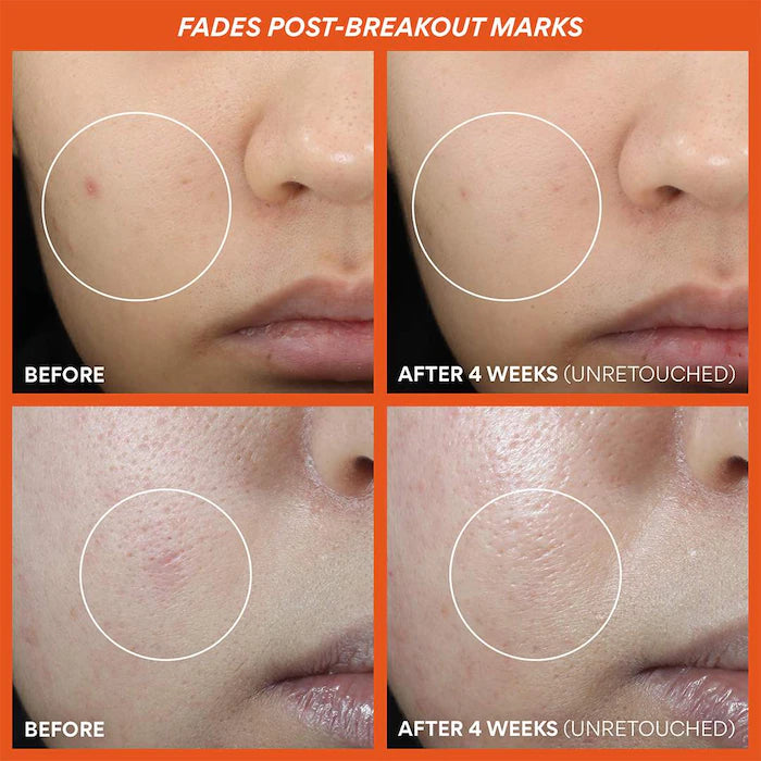 Innisfree  Green Tea Enzyme Vitamin C Brightening + Exfoliating Toner Pads