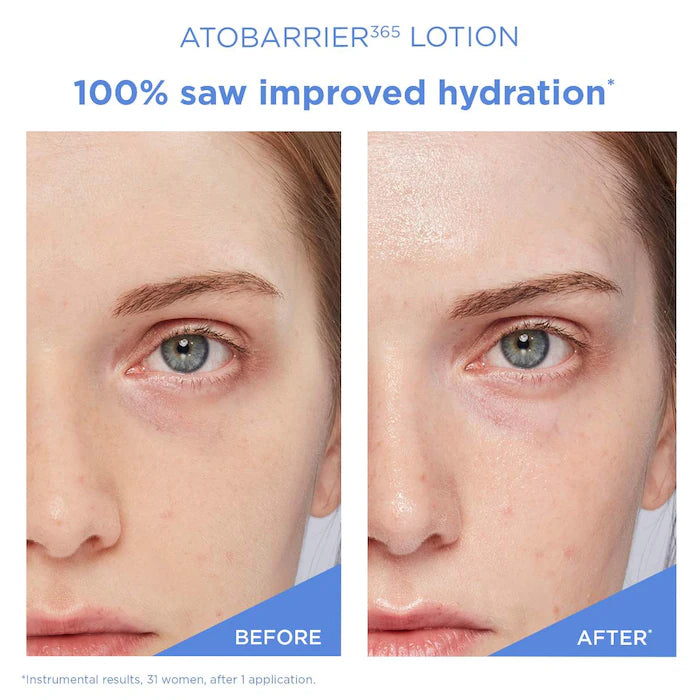 AESTURA  ATOBARRIER365 Lightweight Face Lotion Moisturizer with Ceramides & Niacinamide for Skin Moisture Barrier Repair